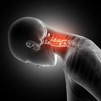 Cervicale osteochondrose