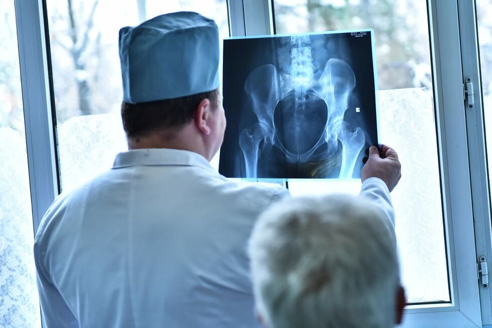 De arts kijkt naar een foto van een heupgewricht met artrose